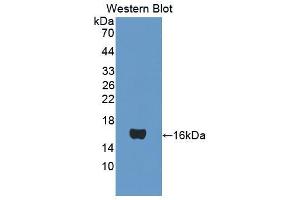 Figure. (ATP5J antibody  (AA 1-108))