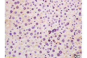 Formalin-fixed and paraffin embedded mouse liver labeled with Anti-SRRM2 Polyclonal Antibody, Unconjugated (ABIN873267) at 1:200 followed by conjugation to the secondary antibody and DAB staining. (SRRM2 antibody  (AA 101-230))