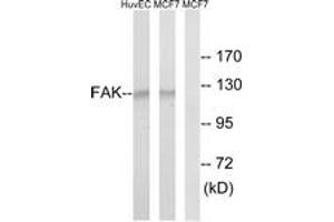 Western blot analysis of extracts from MCF-7/HuvEc cells, using FAK (Ab-843) Antibody. (FAK antibody  (AA 809-858))