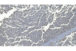 IHC analysis of GRX2/GLRX2 using anti-GRX2/GLRX2 antibody (ABIN7599022).