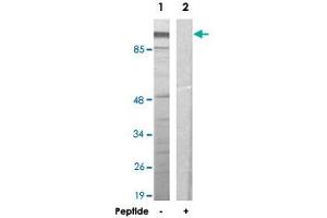 Western blot analysis of extracts from HeLa cells, using ZNF337 polyclonal antibody . (ZNF337 antibody)