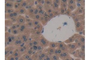 Detection of DKK3 in Mouse Liver Tissue using Polyclonal Antibody to Dickkopf Related Protein 3 (DKK3) (DKK3 antibody  (AA 23-349))