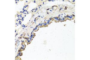 Immunohistochemistry of paraffin-embedded rat lung using TUBB8 antibody.