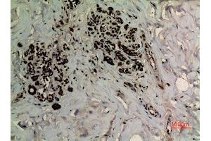 Immunohistochemistry (IHC) analysis of paraffin-embedded Human Breast, antibody was diluted at 1:100. (APEX1 antibody  (acLys6))