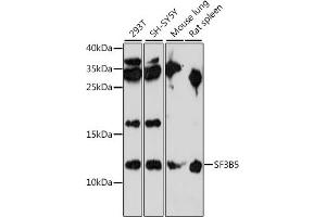 Western blot analysis of extracts of various cell lines, using SF3B5 antibody (ABIN7270546) at 1:1000 dilution. (SF3B5 antibody  (AA 1-86))