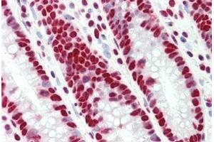 Human Colon: Formalin-Fixed, Paraffin-Embedded (FFPE)