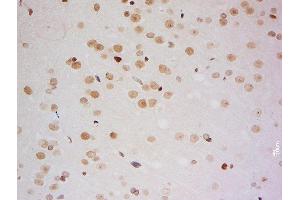 Formalin-fixed and paraffin embedded rat brain labeled with Anti-ZMYM2/ZNF198 Polyclonal Antibody, Unconjugated  at 1:200 followed by conjugation to the secondary antibody and DAB staining (ZMYM2 antibody  (AA 1051-1150))