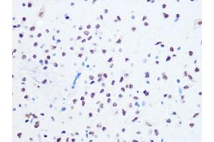 Immunohistochemistry of paraffin-embedded rat brain using OGG1 Rabbit mAb (ABIN7265349) at dilution of 1:100 (40x lens). (OGG1 antibody)