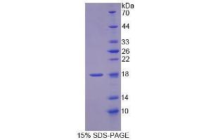 Image no. 1 for Methylmalonyl CoA Epimerase (MCEE) (AA 39-178) protein (His tag) (ABIN6239709) (MCEE Protein (AA 39-178) (His tag))