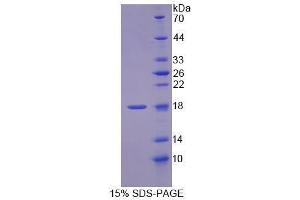 Image no. 1 for Methylmalonyl CoA Epimerase (MCEE) (AA 39-178) protein (His tag) (ABIN5665125)