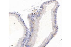 Immunohistochemistry (Paraffin-embedded Sections) (IHC (p)) image for anti-Tetraspanin 1 (TSPAN1) antibody (ABIN7075867)