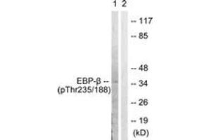 Western blot analysis of extracts from HepG2 cells treated with EGF 200ng/ml 30', using C/EBP-beta (Phospho-Thr235/188) Antibody. (CEBPB antibody  (pThr235))