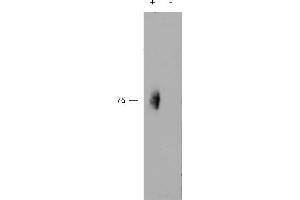 ABIN570901 (2µg/ml) staining of IP from a lysate of Human Natural Killer cells with (+) or without (-) pervanadate treatment of the cells. (2B4 antibody  (Internal Region))