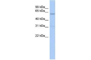 WB Suggested Anti-CAMKK2 Antibody Titration: 0.