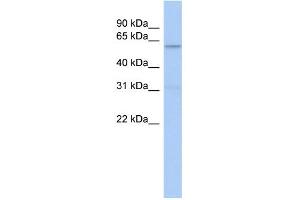 WB Suggested Anti-CAMKK2 Antibody Titration: 0. (CAMKK2 antibody  (N-Term))