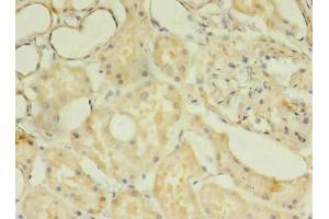 Immunohistochemistry of paraffin-embedded human kidney tissue using ABIN7171830 at dilution of 1:100