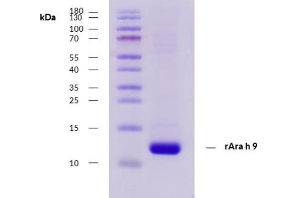 SCP2 Protein