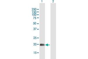 Western Blot analysis of IFNA21 expression in transfected 293T cell line by IFNA21 MaxPab polyclonal antibody. (IFNA21 antibody  (AA 1-189))