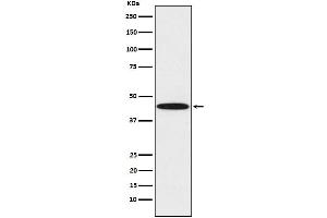 Western blot analysis of DDB2 expression in HeLa cell lysate.