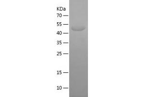Western Blotting (WB) image for Potassium Voltage-Gated Channel, Shab-Related Subfamily, Member 1 (KCNB1) (AA 640-858) protein (His-IF2DI Tag) (ABIN7124533) (Kv2.1/KCNB1 Protein (AA 640-858) (His-IF2DI Tag))