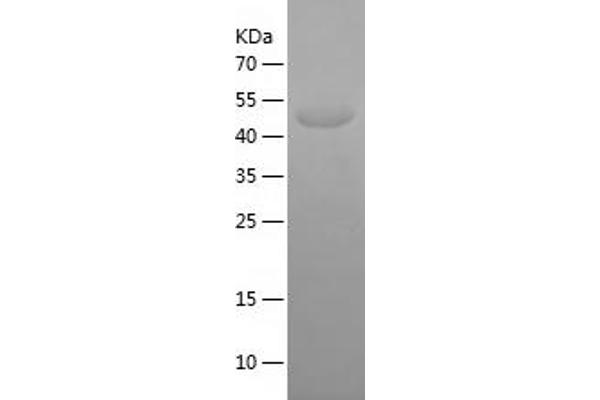 Kv2.1/KCNB1 Protein (AA 640-858) (His-IF2DI Tag)