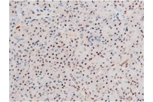 Immunohistochemistry (IHC) image for anti-GATA Binding Protein 4 (GATA4) (pSer262) antibody (ABIN6256227)