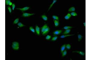 Immunofluorescence staining of Hela cells with ABIN7151703 at 1:133, counter-stained with DAPI. (HSP9B1 (AA 27-799) antibody)