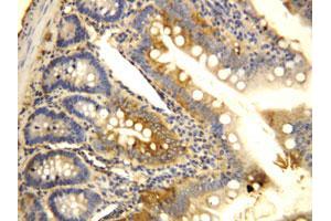 Immunohistochemical staining of CCR6 on formalin fixed, paraffin embedded rat intestine with CCR6 polyclonal antibody .