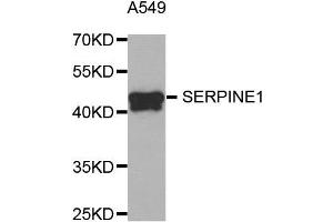 Western Blotting (WB) image for anti-Plasminogen Activator Inhibitor 1 (SERPINE1) antibody (ABIN1882338) (PAI1 antibody)