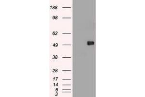 Image no. 11 for anti-Myc Proto-Oncogene protein (MYC) antibody (ABIN1497013) (c-MYC antibody)