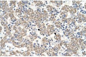 Immunohistochemical staining (Formalin-fixed paraffin-embedded sections) of human liver with KYNU polyclonal antibody . (KYNU antibody  (AA 251-300))