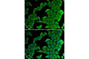 Immunofluorescence analysis of U2OS cells using SMYD2 antibody (ABIN6130910, ABIN6148167, ABIN6148168 and ABIN6222133). (SMYD2A antibody  (AA 1-270))