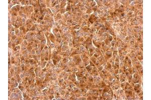 IHC-P Image Granulins antibody detects GRN protein at cytosol on HBL435 xenograft by immunohistochemical analysis. (Granulin antibody  (Center))