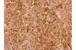 IHC-P Image Granulins antibody detects GRN protein at cytosol on HBL435 xenograft by immunohistochemical analysis.