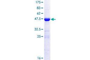 CRIP2 Protein (AA 1-208) (GST tag)