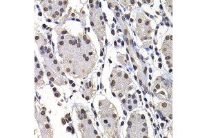 Immunohistochemistry of paraffin-embedded human stomach using H2AFY antibody at dilution of 1:100 (x400 lens). (H2AFY antibody)