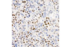 Immunohistochemistry (IHC) image for anti-Cyclin-Dependent Kinase Inhibitor 1A (p21, Cip1) (CDKN1A) antibody (ABIN7266599)