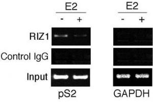 Image no. 4 for anti-PR Domain Containing 2, with ZNF Domain (PRDM2) (AA 1-347) antibody (ABIN3032300)
