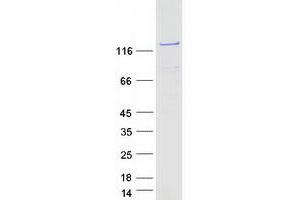 Validation with Western Blot (PHKA2 Protein (Myc-DYKDDDDK Tag))