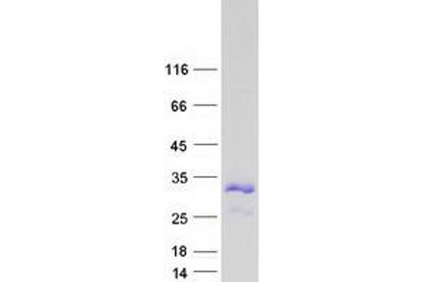 Suprabasin Protein (SBSN) (Myc-DYKDDDDK Tag)