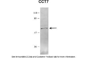 Sample Type: HEK 293 (10ug)Primary Dilution: 1:1000Secondary Antibody: conjugated goat anti-rabbitSecondary Dilution: 1:10,000Image Submitted By: Amy GrayBrigham Young University (CCT7 antibody  (C-Term))