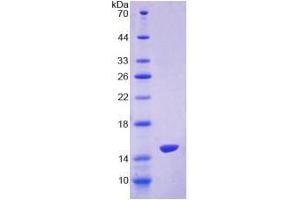 SDS-PAGE (SDS) image for Oxytocin, Prepropeptide (OXT) (AA 20-125) protein (His tag) (ABIN6239508)