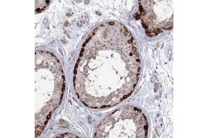 Immunohistochemical staining of human testis with STT3B polyclonal antibody  shows strong cytoplasmic positivity in spermatogonia.
