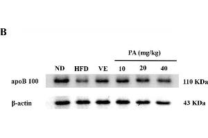 PA treatment attenuated HFD-induced apoB 100 reduction in rats. (APOB antibody  (AA 28-330))