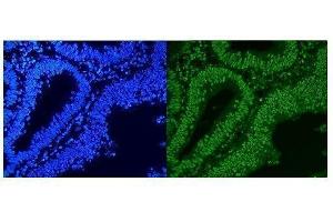 IF analysis of HnRNP A1 using anti-HnRNP A1 antibody (ABIN4886621).