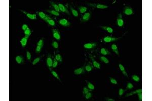 Immunofluorescence staining of Hela cells with ABIN7164137 at 1:100, counter-stained with DAPI. (PBX1 antibody  (AA 315-430))