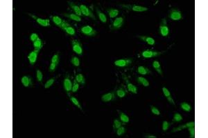 Immunofluorescence staining of Hela cells with ABIN7164137 at 1:100, counter-stained with DAPI. (PBX1 antibody  (AA 315-430))