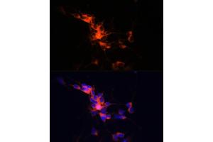 Immunofluorescence analysis of SH-SY5Y cells using βIII-Tubulin/β3-Tubulin Rabbit mAb (ABIN7271049) at dilution of 1:100 (40x lens). (TUBB3 antibody)