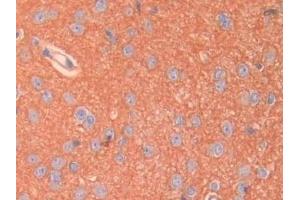 Detection of SPTAN1 in Rat Cerebrum Tissue using Polyclonal Antibody to Alpha-Fodrin (SPTAN1) (SPTAN1 antibody  (AA 2071-2269))