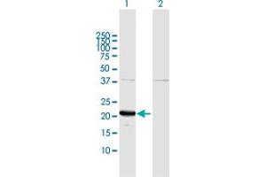 Western Blot analysis of GLO1 expression in transfected 293T cell line by GLO1 MaxPab polyclonal antibody. (GLO1 antibody  (AA 1-184))